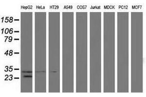 Image no. 2 for anti-Glutathione S-Transferase theta 2 (GSTT2) antibody (ABIN1498555) (GSTT2 antibody)