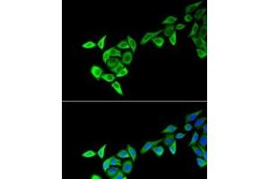 Immunofluorescence analysis of HeLa cells using MECOM Polyclonal Antibody (MECOM antibody)