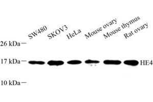 Western blot analysis of HE4 (ABIN7076209) at dilution of 1: 500