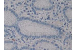 Immunohistochemistry (IHC) image for anti-Hypoxia Inducible Factor 1, alpha Subunit Inhibitor (HIF1AN) (AA 31-349) antibody (ABIN7441979)