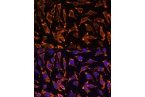 Immunofluorescence analysis of L929 cells using TNFRSF11A Polyclonal Antibody (ABIN6127589, ABIN6149310, ABIN6149312 and ABIN6217357) at dilution of 1:100 (40x lens). (TNFRSF11A antibody  (AA 466-616))