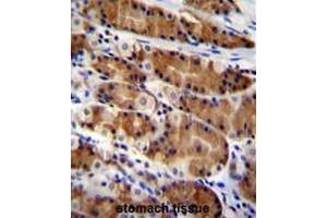 CCDC84 Antibody (N-term) immunohistochemistry analysis in formalin fixed and paraffin embedded human stomach tissue followed by peroxidase conjugation of the secondary antibody and DAB staining. (CCDC84 antibody  (N-Term))