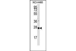 Image no. 1 for anti-Phosphatidic Acid Phosphatase Type 2C (PPAP2C) (C-Term) antibody (ABIN357966) (PPAP2C antibody  (C-Term))