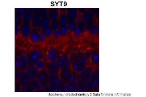 Sample Type: outer mouse plexiform layerRed: PrimaryBlue: DAPIPrimary Dilution: 1:200Secondary Antibody: Goat anti-Rabbit AF568 IgG(H+L)Secondary Dilution: 1:200Image Submitted by: David ZenisekYale University (SYT9 antibody  (Middle Region))
