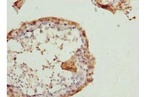 Immunohistochemistry of paraffin-embedded human testis tissue using ABIN7167361 at dilution of 1:100 (RAB5B antibody  (AA 1-215))