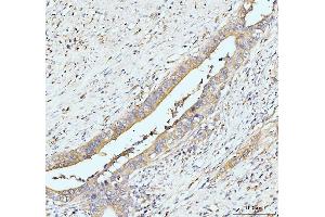 IHC analysis of GIT1 using anti-GIT1 antibody (ABIN7601683). (GIT1 antibody  (AA 415-736))