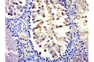 Paraformaldehyde-fixed, paraffin embedded rat testis tissue, Antigen retrieval by boiling in sodium citrate buffer(pH6) for 15min, Block endogenous peroxidase by 3% hydrogen peroxide for 30 minutes, Blocking buffer (normal goat serum) at 37°C for 20min, Antibody incubation with Rabbit Anti-MYCBPAP Polyclonal Antibody, Unconjugated  at 1:500 overnight at 4°C, followed by a conjugated secondary and DAB staining (MYCBPAP antibody  (AA 401-500))