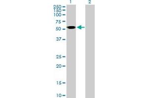 Western Blot analysis of ASL expression in transfected 293T cell line by ASL MaxPab polyclonal antibody. (ASL antibody  (AA 1-464))