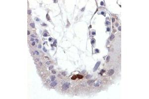 Immunohistochemistry staining of Wild-type p53 expressed in human trophoblast (paraffin-embedded sections).