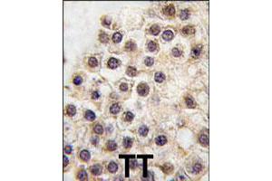 Formalin-fixed and paraffin-embedded human testis tissue reacted with ARID3B polyclonal antibody  , which was peroxidase-conjugated to the secondary antibody, followed by DAB staining. (ARID3B antibody  (C-Term))