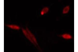 ABIN6275512 staining  HeLa cells by IF/ICC. (RUFY1 antibody  (Internal Region))