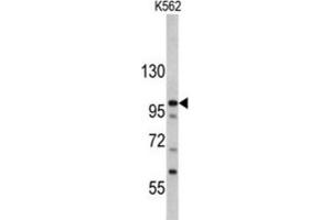 Western Blotting (WB) image for anti-MDM2 Binding Protein (MTBP) antibody (ABIN3002735) (MTBP antibody)
