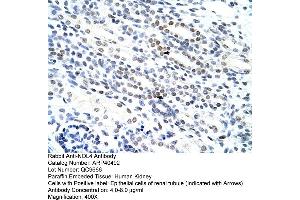 Rabbit Anti-NOL4 Antibody  Paraffin Embedded Tissue: Human Kidney Cellular Data: Epithelial cells of renal tubule Antibody Concentration: 4. (NOL4 antibody  (N-Term))