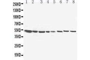 Lane 8: COLO320 Cell Lysate (HSD17B4 antibody  (C-Term))