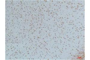 Immunohistochemistry (IHC) analysis of paraffin-embedded Mouse Brain Tissue using CaMKIIbeta/ gamma /delta (Phospho Thr287) Mouse Monoclonal Antibody diluted at 1:200. (CaMKIIbeta/gamma/delta antibody  (pThr287))