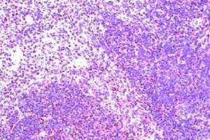 Immunohistochemistry on paraffin section of human spleen (CCR8 antibody  (AA 7-33))