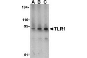 Western blot analysis of TLR1 in mouse spleen lysate with this product at (A) 1, (B) 2, and (C) 4 μg/ml. (TLR1 antibody  (N-Term))