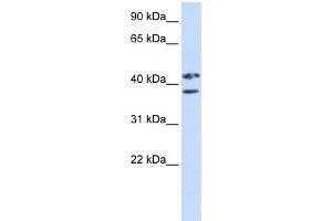 WB Suggested Anti-ZRANB2 Antibody Titration:  0.