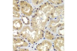 Immunohistochemistry of paraffin-embedded human kidney using CEBPG antibody (ABIN5974381) at dilution of 1/100 (40x lens). (CEBPG antibody)