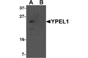 Western blot analysis of YPEL1 in Hela cell lysate with YPEL1 antibody at 1 ug/mL in (A) the absence and (B) the presence of blocking peptide.