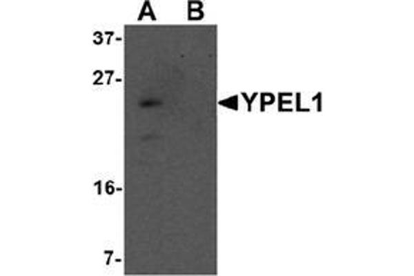 YPEL1 Antikörper  (N-Term)