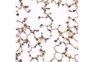 Immunohistochemistry of paraffin-embedded mouse lung using PIP4K2A antibody (ABIN6130624, ABIN6145673, ABIN6145674 and ABIN6223324) at dilution of 1:100 (40x lens). (PIP4K2A antibody  (AA 120-350))