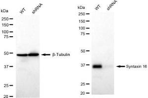 anti-Syntaxin 16 (STX16) antibody