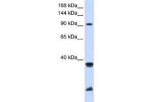 WB Suggested Anti-RNF20 Antibody Titration:  0. (RNF20 antibody  (Middle Region))