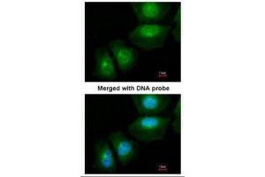 ICC/IF Image Immunofluorescence analysis of paraformaldehyde-fixed HeLa, using S100A11, antibody at 1:200 dilution. (S100A11 antibody)