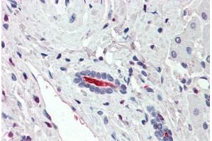 Anti-SLC5A1 / SGLT1 antibody  ABIN960813 IHC staining of human liver. (SLC5A1 antibody  (N-Term))