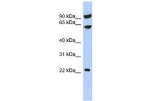 Image no. 1 for anti-Tigger Transposable Element Derived 3 (TIGD3) (AA 395-444) antibody (ABIN6743511) (TIGD3 antibody  (AA 395-444))
