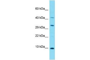 Host: Rabbit Target Name: C17orf89 Sample Type: Fetal Lung lysates Antibody Dilution: 1. (C17ORF89 antibody  (N-Term))
