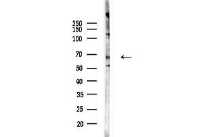 anti-Potassium Intermediate/small Conductance Calcium-Activated Channel, Subfamily N, Member 2 (KCNN2) (C-Term) antibody