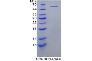 SDS-PAGE (SDS) image for Protein L-Myc (MYCL) (AA 186-439) protein (His tag,GST tag) (ABIN2123740)