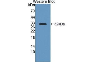 Western blot analysis of the recombinant protein. (PVRL4 antibody  (AA 31-317))