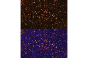 Immunofluorescence analysis of rat spleen using CCR7 Rabbit mAb (ABIN7266309) at dilution of 1:100 (40x lens). (CCR7 antibody)