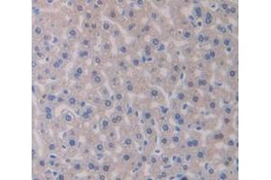 IHC-P analysis of Mouse Tissue, with DAB staining. (GBA antibody  (AA 255-509))