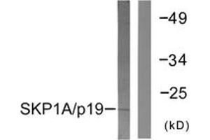 Western blot analysis of extracts from COS7 cells, using SKP1A/p19 Antibody. (SKP1 antibody  (AA 41-90))