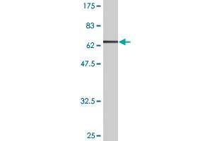 Western Blot detection against Immunogen (63. (Follistatin antibody  (AA 1-344))