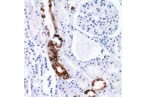 Immunohistochemical analysis of EGF staining in human kidney formalin fixed paraffin embedded tissue section.