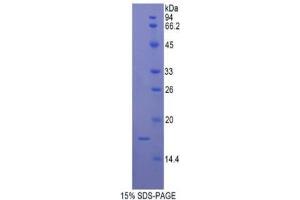 SDS-PAGE analysis of Human UCP2 Protein. (UCP2 Protein)