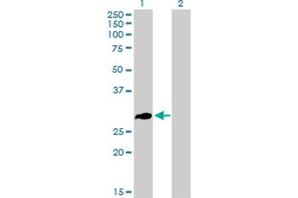 ZNF32 antibody  (AA 1-273)