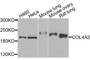 Western blot analysis of extracts of various cells, using COL4A2 antibody. (COL4a2 antibody)