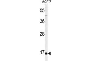 Western Blotting (WB) image for anti-Biorientation of Chromosomes in Cell Division 1 (BOD1) antibody (ABIN3004401)