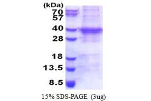 SDS-PAGE (SDS) image for Ubiquitin-Conjugating Enzyme E2R 2 (UBE2R2) (AA 1-238) protein (His tag) (ABIN5853300) (UBE2R2 Protein (AA 1-238) (His tag))
