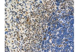 Phospho-UHRF1 (Ser311) Antibody at 1/100 staining Rat spleen tissue by IHC-P.