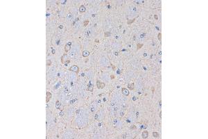Immunohistochemistry of paraffin-embedded Mouse brain using OR2S2 Rabbit pAb (ABIN7269087) at dilution of 1:100 (40x lens). (OR2S2 antibody  (AA 200-300))