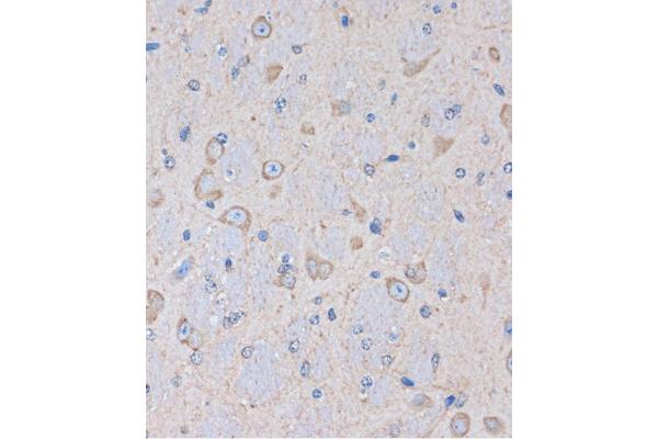 OR2S2 antibody  (AA 200-300)