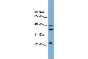 WB Suggested Anti-SAE1  Antibody Titration: 0.