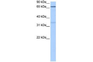 PADI2 antibody used at 0. (PADI2 antibody  (Middle Region))